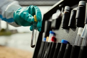 researcher hand holding test tube with water sample for chemical contamination analysis